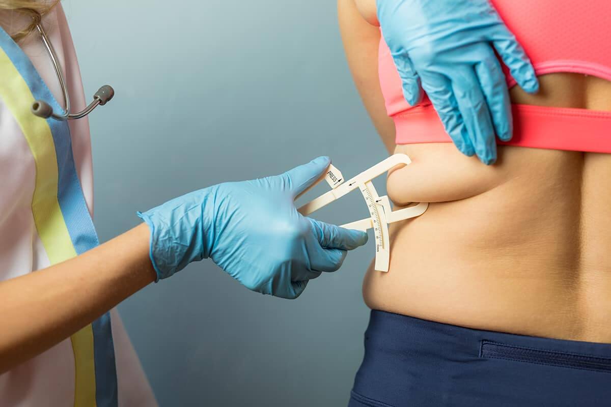 ¿Cuál es la diferencia entre la liposucción y la pérdida de peso?