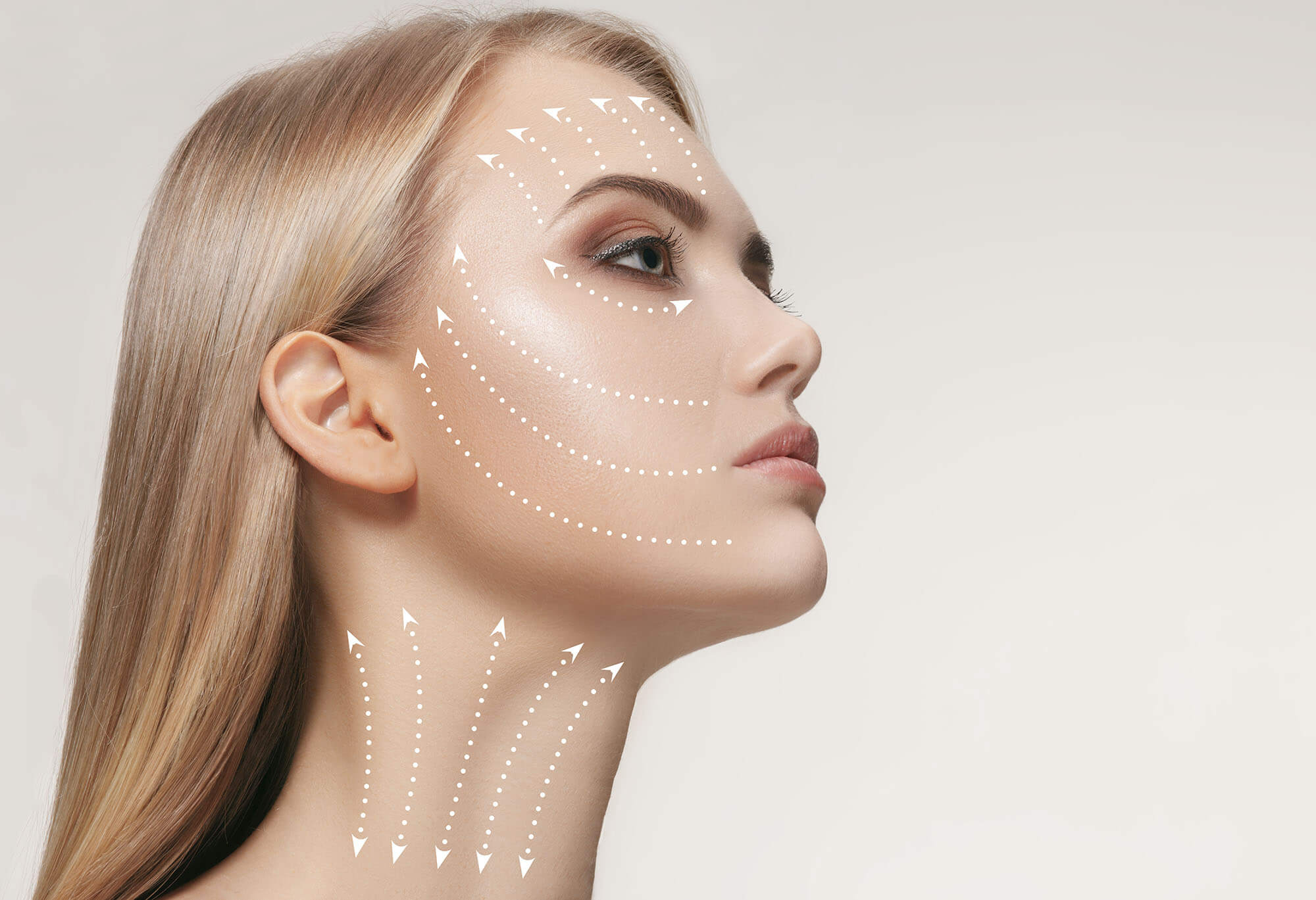 Lifting Facial en Perú: ¿Qué es?