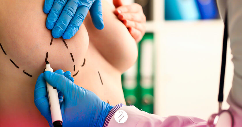 ¿En qué consiste la mamoplastia con grasa?