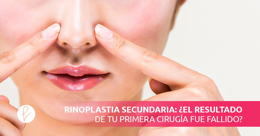 Rinoplastia Secundaria: ¿Resultado malo de tu Primera Cirugía?