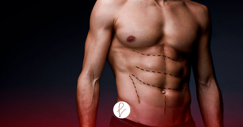 ¿Cómo sé si soy candidato para la cirugía de abdominales que define el abdomen para hombre?