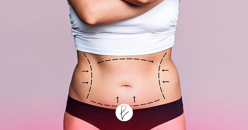 Dos procedimientos para eliminar la barriga post embarazo