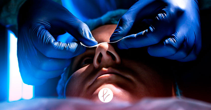 ¿Qué temas relacionados a la rinoplastia se abordarán?