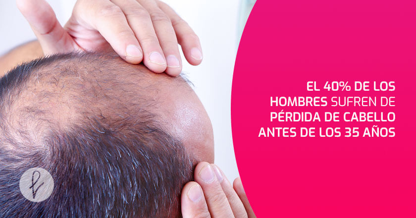 Un dato y un mito sobre la calvicie que queremos compartir