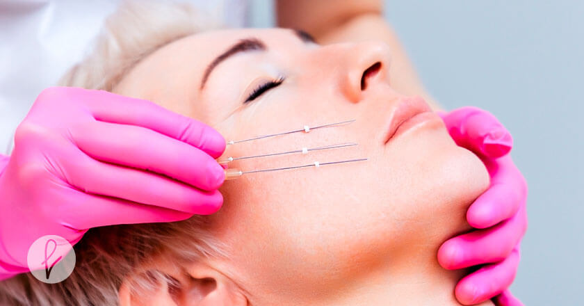 ¿Te imaginas un lifting facial sin cirugía?
