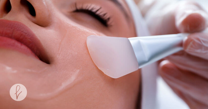 Peeling químico para las arrugas