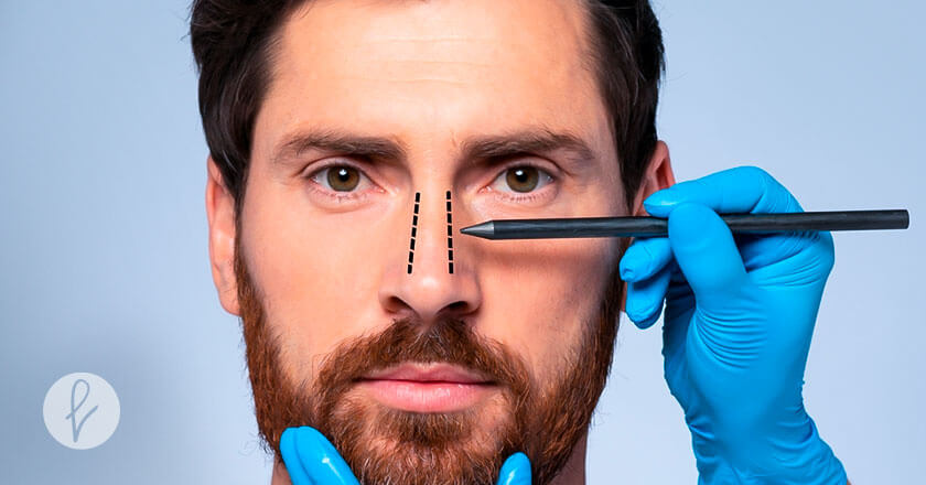 ¿Qué es una rinoplastia?