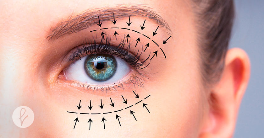 Tipos de Blefaroplastia