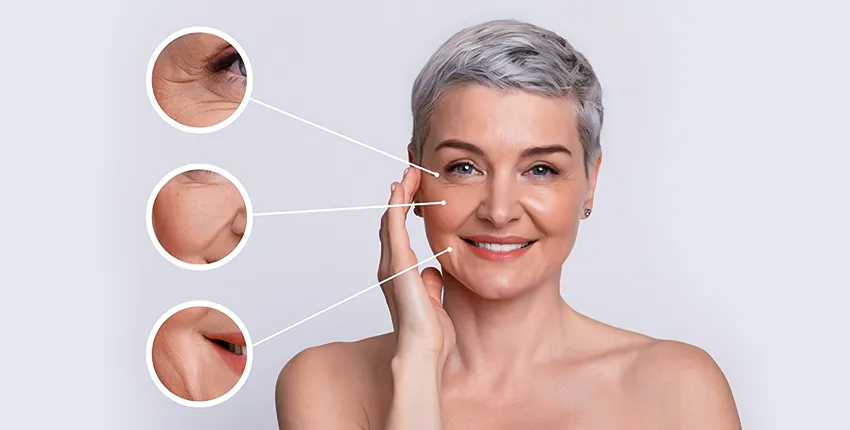 Beneficios de un Lifting Facial Beneficios de un Lifting Facial