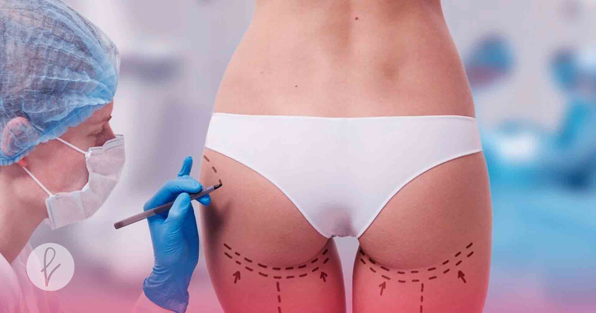 ¿Qué más lograré en mi consulta con el cirujano plástico?