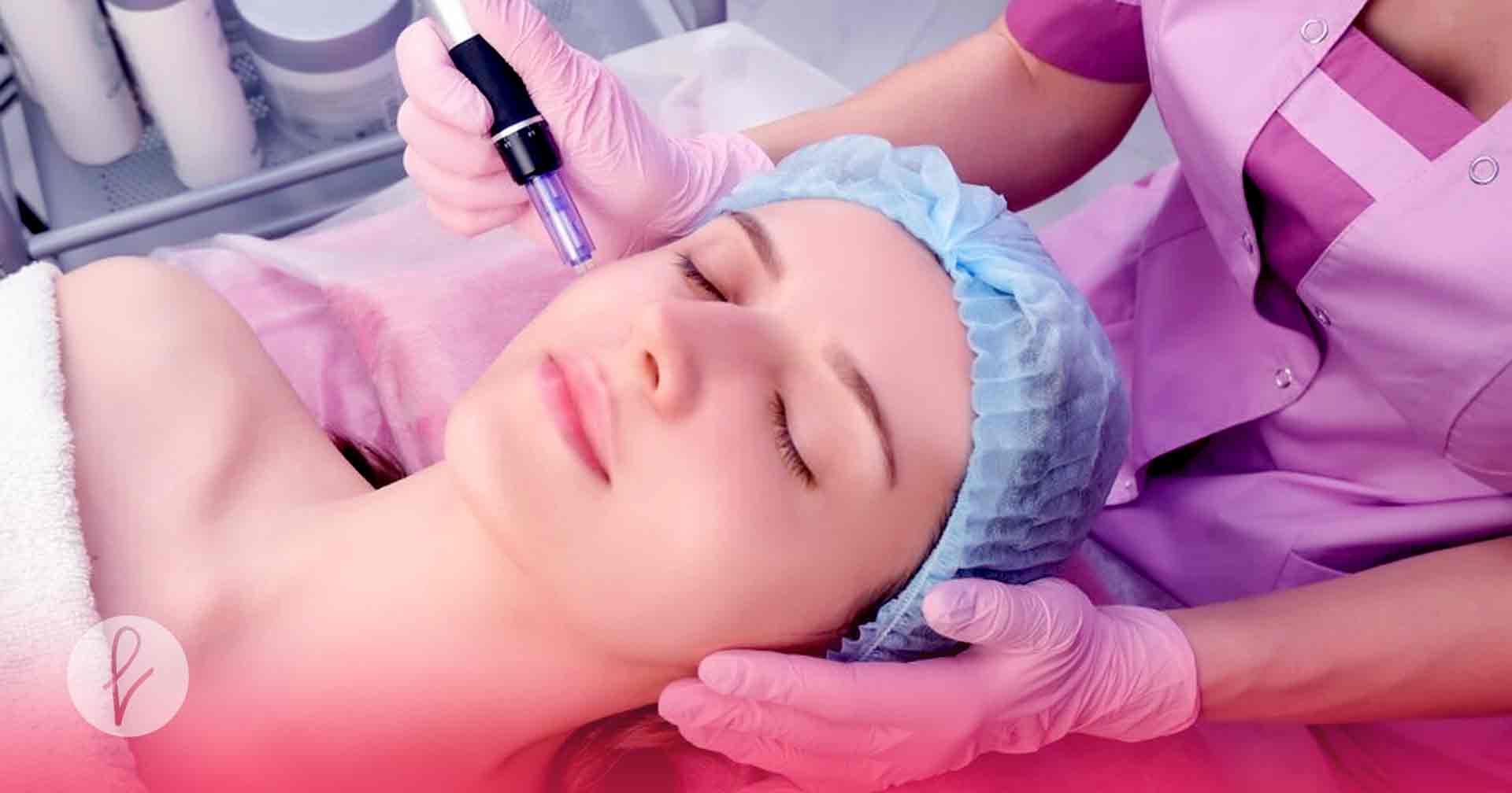 ¿Qué es el Microneedling?