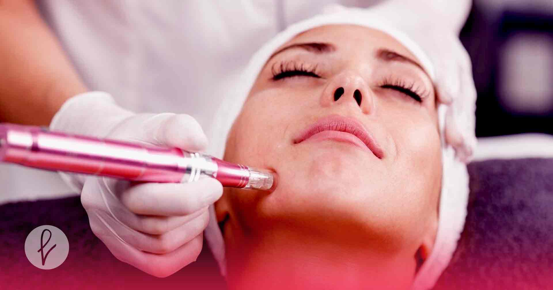 ¿Cuál será el futuro del Microneedling?