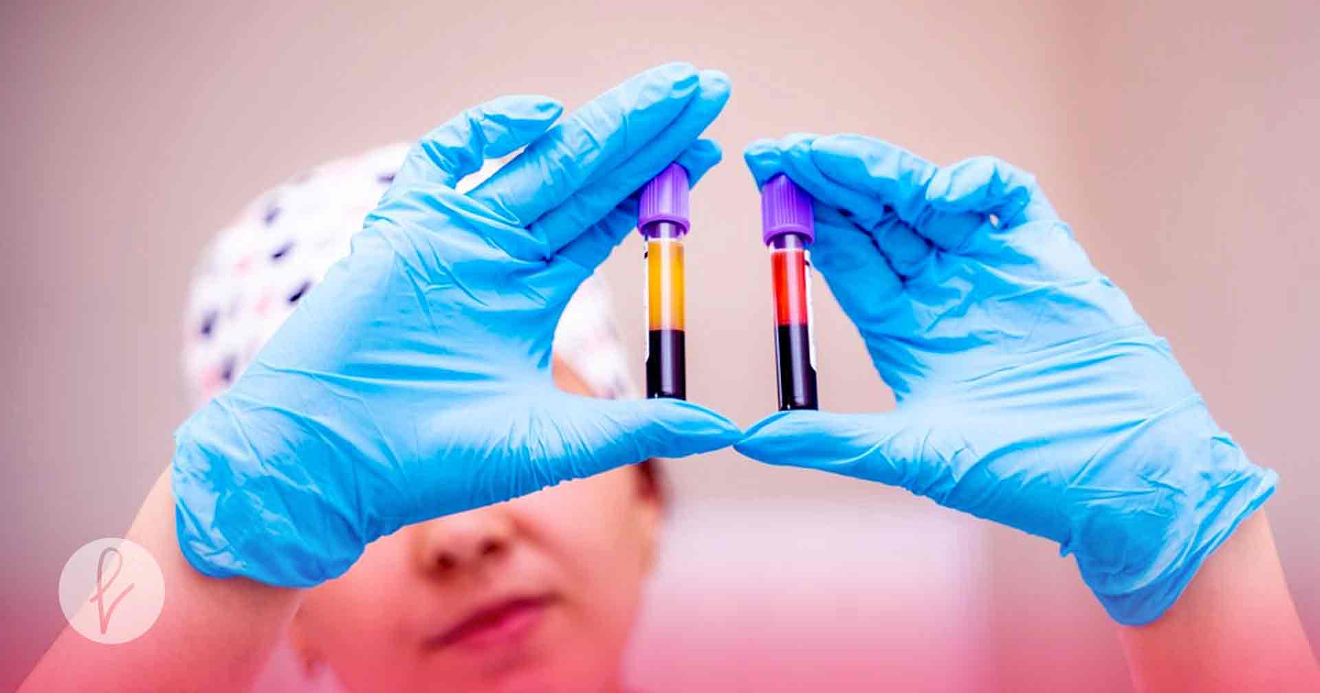 ¿Qué es el Plasma Rico en Plaquetas (PRP)?