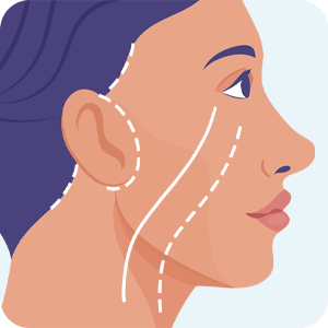 Lifting Facial Plano Profundo Lifting Facial Plano Profundo