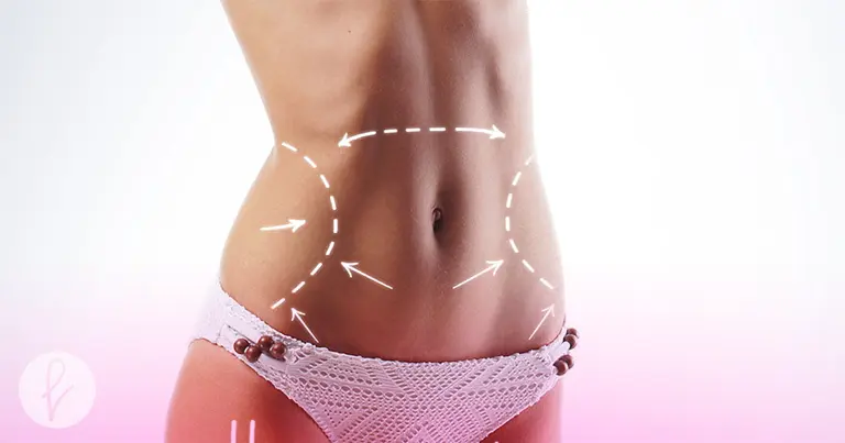Procedimiento de las cirugías de Lipoescultura y Liposucción: