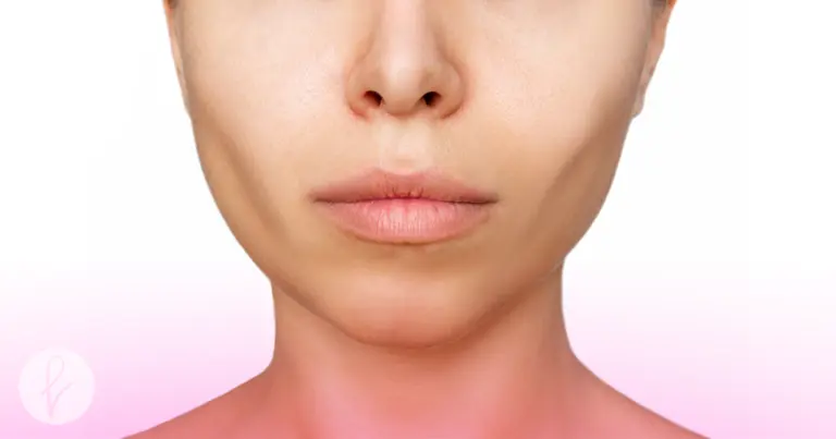 ¿En qué consiste el afinamiento de rostro y cuáles son las cirugías que lo logran?