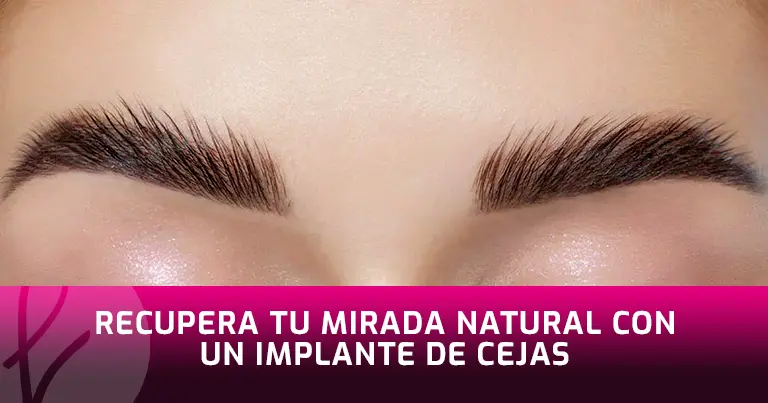 Recupera tu mirada natural con un Implante de Cejas