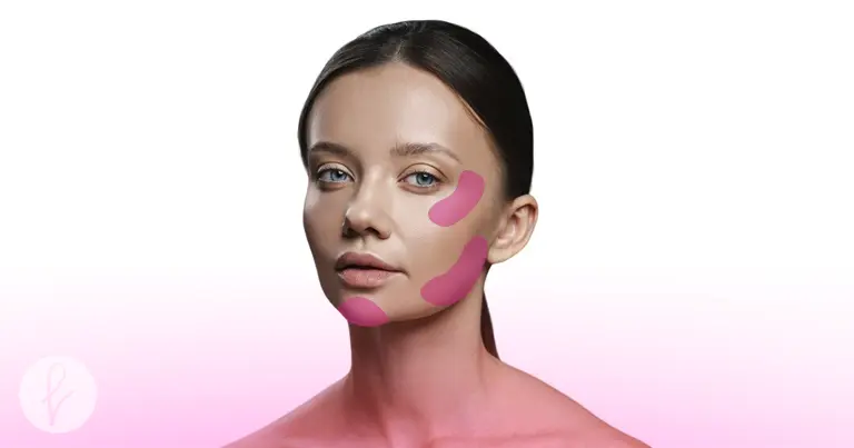 ¿Qué son los implantes faciales?