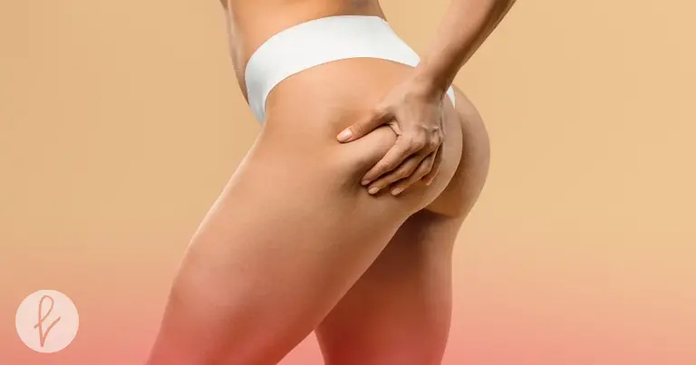 Beneficios de la gluteoplastia