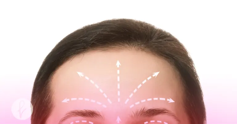 ¿Qué es la Frontoplastia?