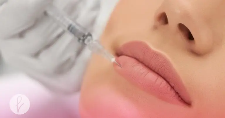 El relleno de labios: volumen y definición inmediata