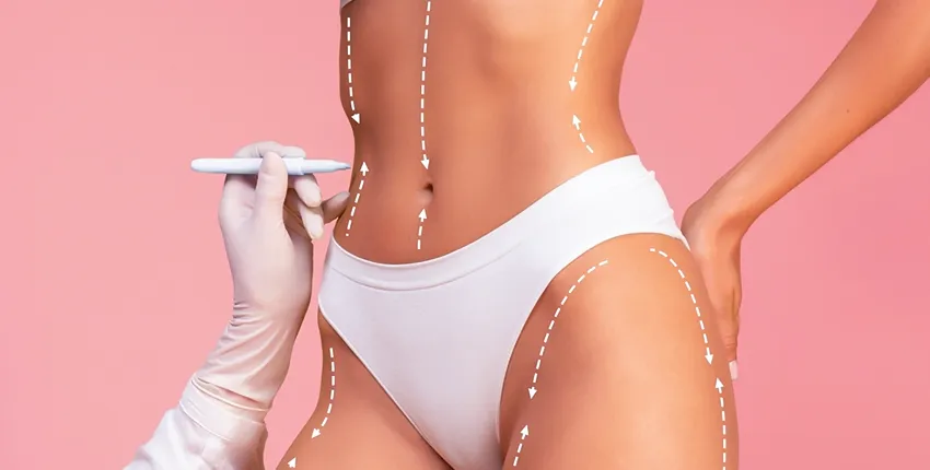 ¿Soy un candidato para una Lipoescultura? ¿Soy un candidato para una Lipoescultura?