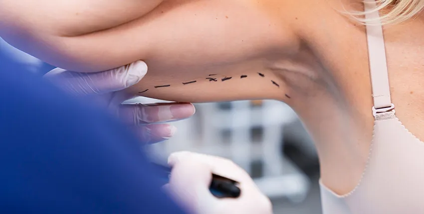 Procedimiento de la Braquioplastia