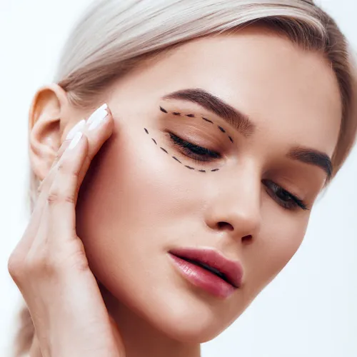 Tipos de Blefaroplastia: Blefaroplastia Completa