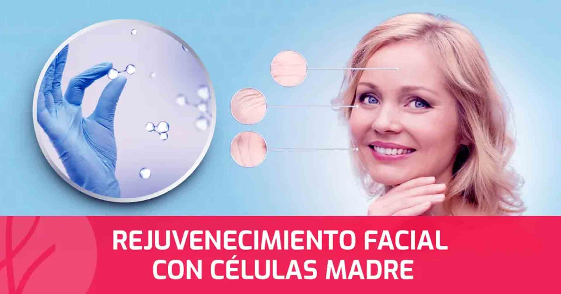 Rejuvenecimiento facial con células madre