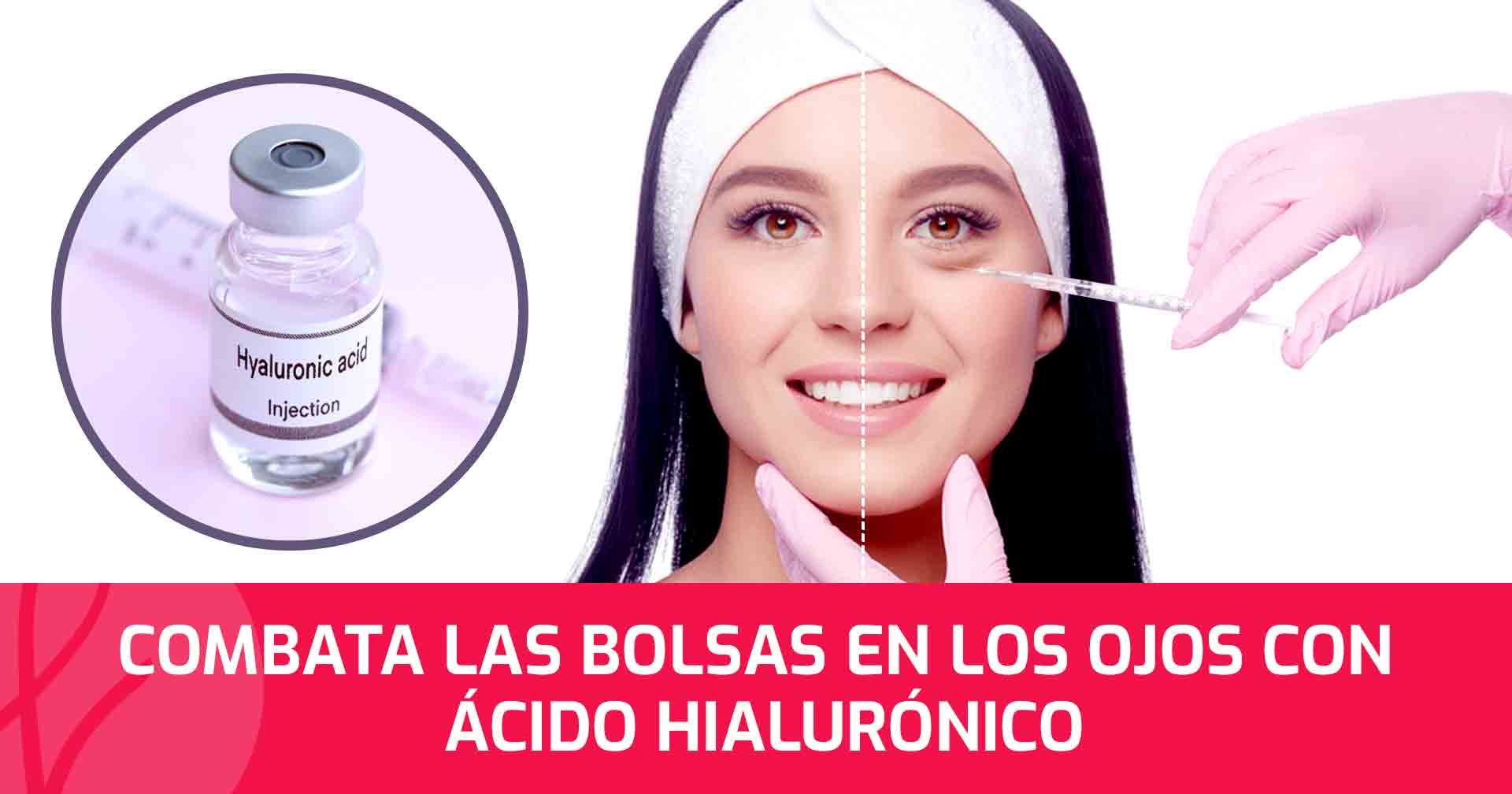 Combata las Bolsas en los Ojos con Ácido Hialurónico