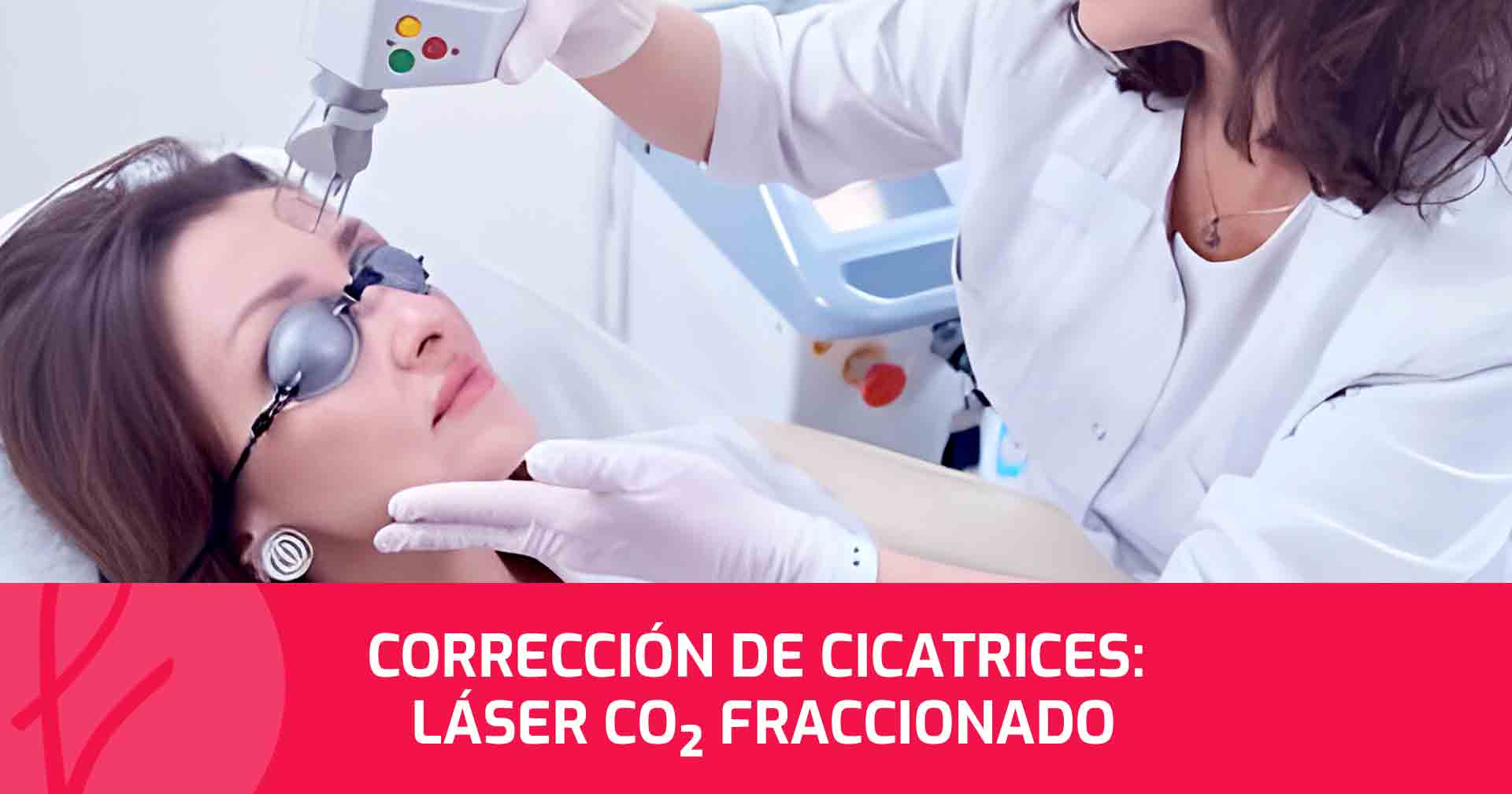 Corrección de Cicatrices: Láser CO2 fraccionado