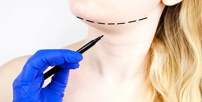 Tipos de Lipopapada