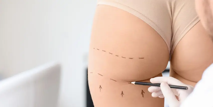 Ácido Hialurónico para el Cuerpo eliminar arrugas
