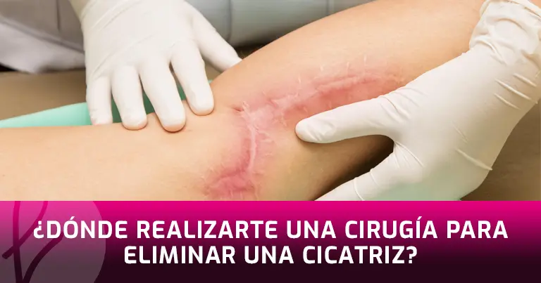 ¿Dónde Realizar una Cirugía para Eliminar Cicatrices?