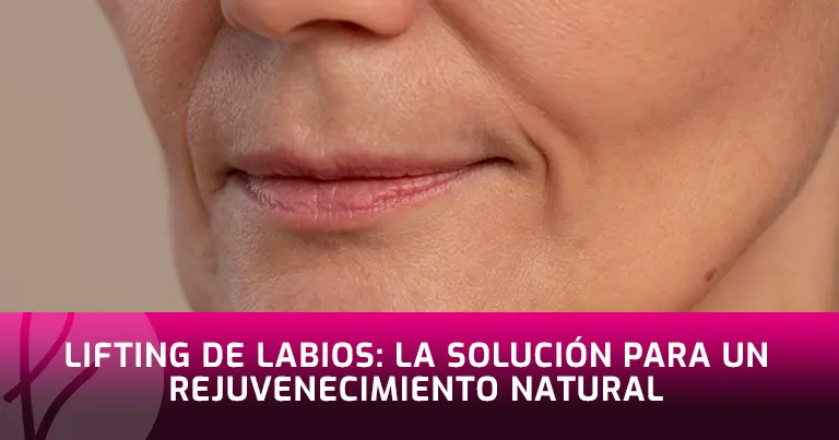 Lifting de Labios: Rejuvenece tu Sonrisa de Forma Natural
