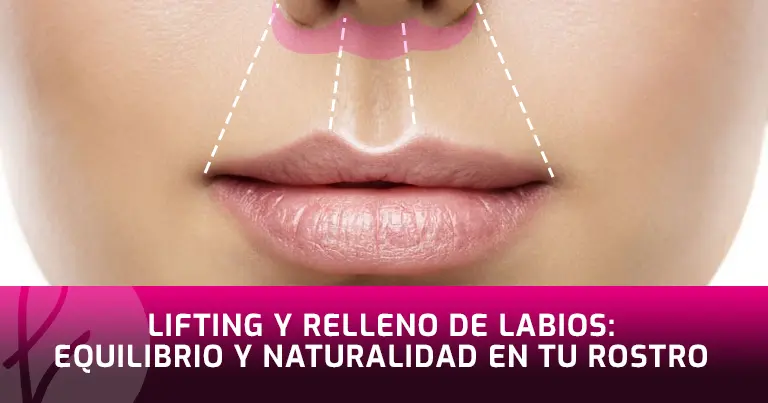 Lifting y Relleno de Labios: Equilibrio y naturalidad en tu rostro