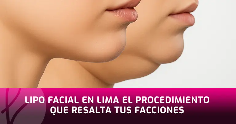 Lipo facial en Lima el procedimiento que resalta tus facciones