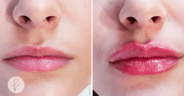 ¿Cuál es la mejor opción para ti?