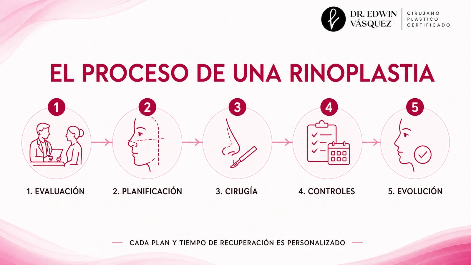 Proceso de rinoplastia: evaluación, planificación, cirugía, controles y evolución