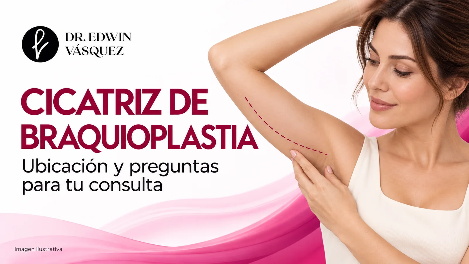Mujer e ilustración sobre ubicación de la cicatriz de braquioplastia — imagen ilustrativa