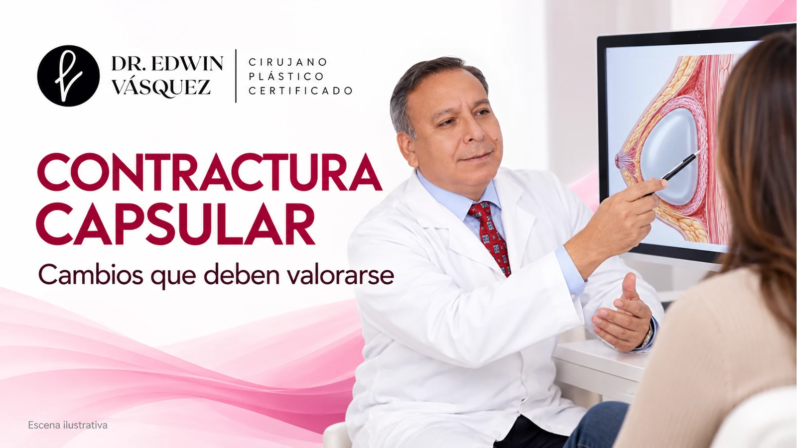 Escena ilustrativa: El Dr. Edwin Vásquez explica un corte anatómico de implante mamario en una consulta ilustrativa sobre contractura capsular.
