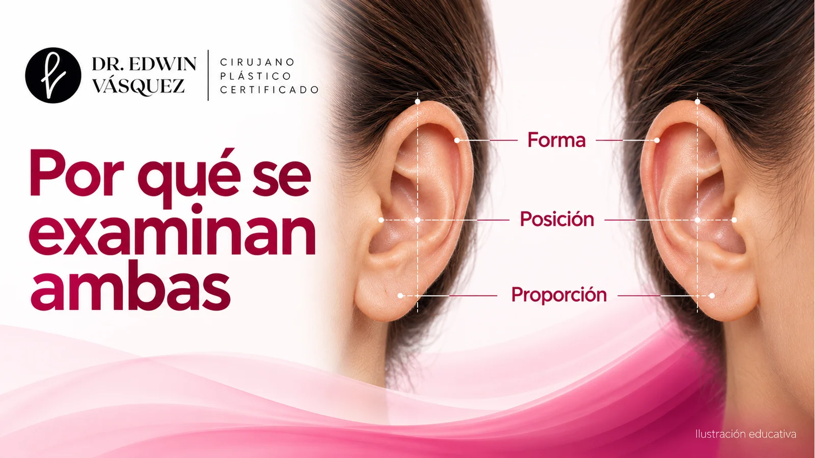Dos orejas ilustradas con diferencias naturales y referencias de forma, posición y proporción.